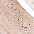 Immunohistochemical staining of mouse hippocampus shows strong nuclear positivity in neurons in ventral CA3 area.