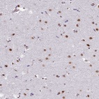 Anti-CHD3 Antibody