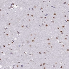 Anti-CHD3 Antibody