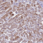 Immunohistochemical staining of human heart muscle shows weak cytoplasmic positivity in cardiomyocytes.