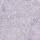 Immunohistochemical staining of human liver shows no positivity in hepatocytes as expected.