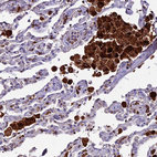 Anti-HIC1 Antibody