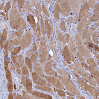 Immunohistochemical staining of human skeletal muscle shows strong cytoplasmic positivity in myocytes.
