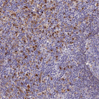 Anti-HIC1 Antibody