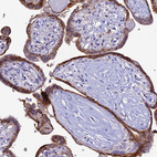 Immunohistochemical staining of human placenta shows strong granular pattern cytoplasmic positivity in trophoblastic cells.