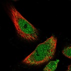 Immunofluorescent staining of human cell line U-251 MG shows localization to nucleoplasm & cytosol.