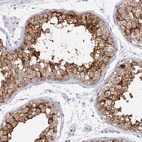 Immunohistochemical staining of human testis shows high expression.