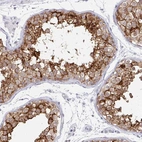 Immunohistochemical staining of human testis shows high expression.