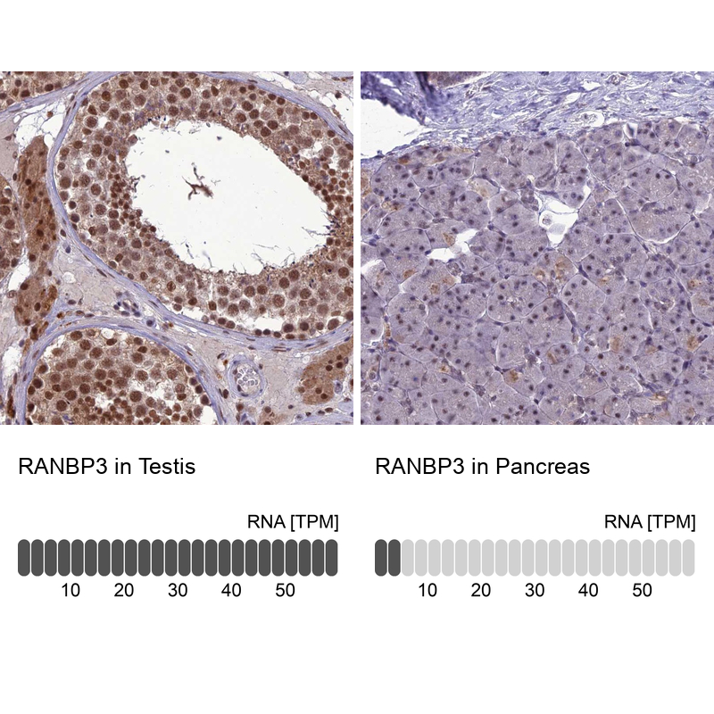 Anti-RANBP3 Antibody