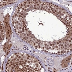 Immunohistochemical staining of human testis shows high expression.