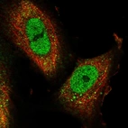 Immunofluorescent staining of human cell line U-251 MG shows localization to nucleoplasm.