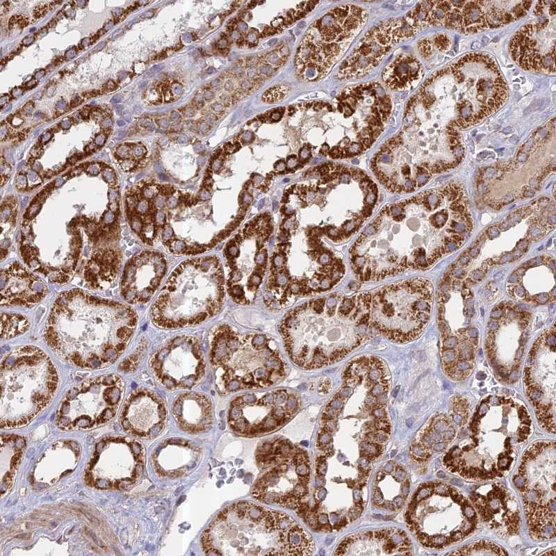 Anti-HMX2 Antibody