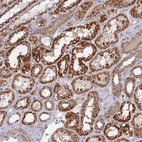 Anti-HMX2 Antibody