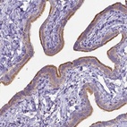 Anti-C4orf22 Antibody