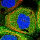 Immunofluorescent staining of human cell line A-431 shows positivity in plasma membrane & cytoplasm.