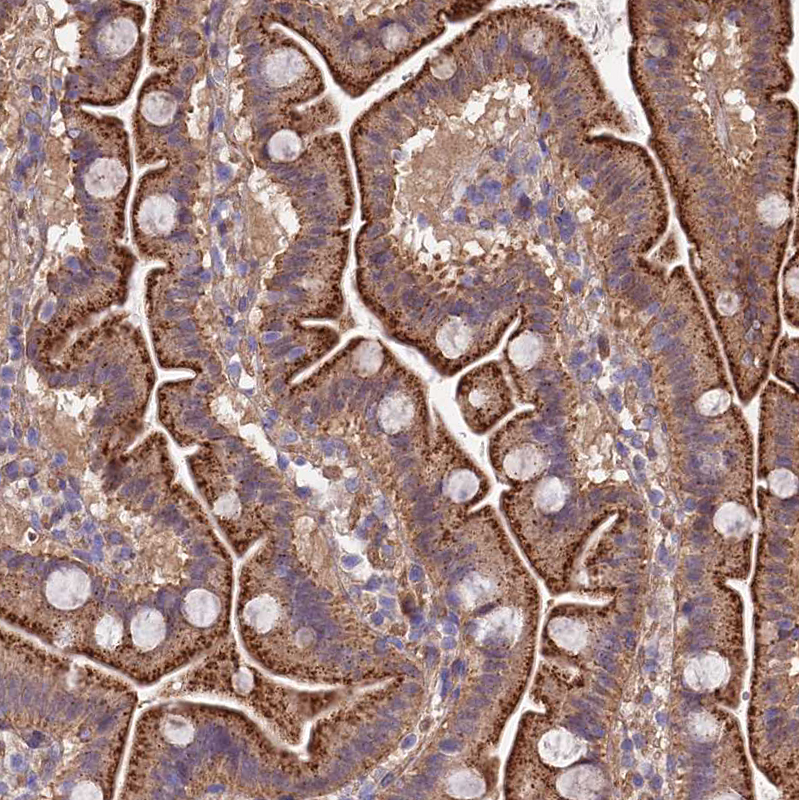 Anti-QRFP Antibody