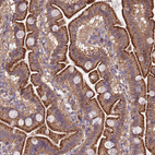 Anti-QRFP Antibody