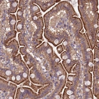 Anti-QRFP Antibody