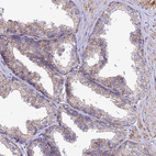 Immunohistochemical staining of human prostate shows weak granular cytoplasmic positivity in glandular cells.