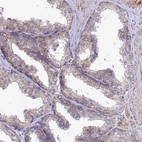 Immunohistochemical staining of human prostate shows weak granular cytoplasmic positivity in glandular cells.