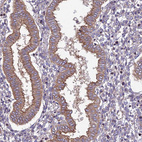 Immunohistochemical staining of human endometrium shows moderate cytoplasmic positivity in glandular cells.