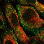 Immunofluorescent staining of human cell line U-2 OS shows localization to cytosol & vesicles.