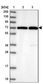 Lane 1: Marker [kDa] 250, 130, 95, 72, 55, 36, 28, 17, 10_br/_Lane 2: Human cell line RT-4_br/_Lane 3: Human cell line U-251MG sp