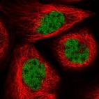 Immunofluorescent staining of human cell line A-431 shows localization to nucleoplasm.