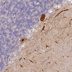 Anti-TRIM3 Antibody