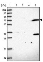 Lane 1: Marker [kDa] 250, 130, 95, 72, 55, 36, 28, 17, 10_br/_Lane 2: Human cell line RT-4_br/_Lane 3: Human cell line U-251MG sp_br/_Lane 4: Human plasma (IgG/HSA depleted)_br/_Lane 5: Human liver tissue