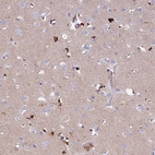 Anti-PRNP Antibody