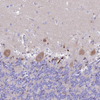 Anti-PRNP Antibody