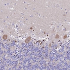 Immunohistochemical staining of human cerebellum shows moderate cytoplasmic positivity in Purkinje cells.