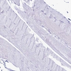 Immunohistochemical staining of human skeletal muscle shows no positivity in myocytes as expected.