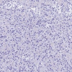 Immunohistochemical staining of human pancreas shows no positivity in exocrine glandular cells as expected.