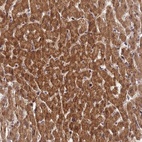 Anti-ZNF584 Antibody