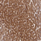Anti-ZNF584 Antibody