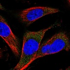 Immunofluorescent staining of human cell line U-251 MG shows localization to vesicles.