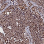 Anti-CEACAM21 Antibody