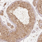 Immunohistochemical staining of human testis shows moderate granular cytoplasmic positivity in cells in seminiferous ducts.