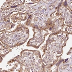 Immunohistochemical staining of human placenta shows moderate granular cytoplasmic positivity in trophoblastic cells.