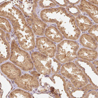 Immunohistochemical staining of human kidney shows moderate granular cytoplasmic positivity in cells in tubules.
