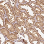 Immunohistochemical staining of human kidney shows moderate granular cytoplasmic positivity in cells in tubules.