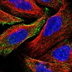 Immunofluorescent staining of human cell line U-2 OS shows localization to vesicles.
