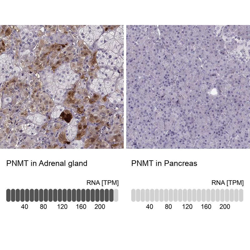 Anti-PNMT Antibody