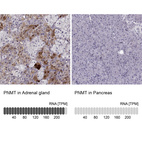 Anti-PNMT Antibody