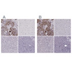 Immunohistochemical staining of human adrenal gland, cerebral cortex, liver and pancreas using Anti-PNMT antibody HPA043412 (A) shows similar protein distribution across tissues to independent antibody HPA051005 (B).