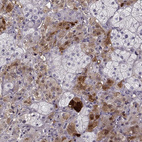 Immunohistochemical staining of human adrenal gland shows moderate to strong cytoplasmic positivity.