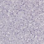 Anti-PNMT Antibody