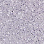 Immunohistochemical staining of human liver shows no positivity in hepatocytes as expected.